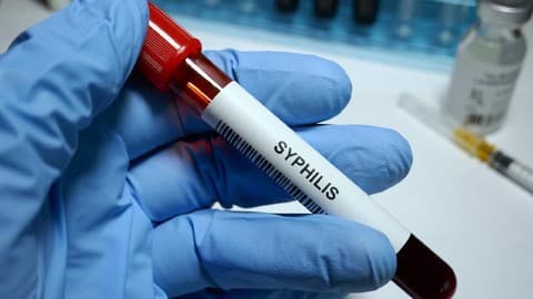 Kasus Sifilis di Jepang Meningkat Sangat Cepat