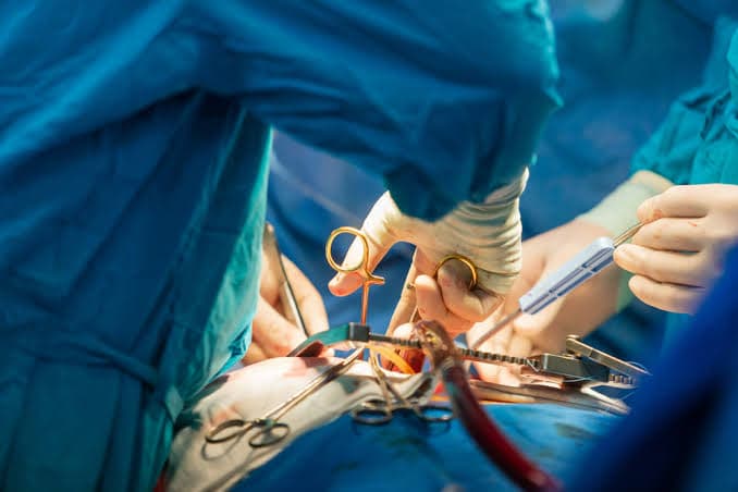 Transplantasi Hati & Paru-Paru Donor Hidup Pertama di Dunia Sukses