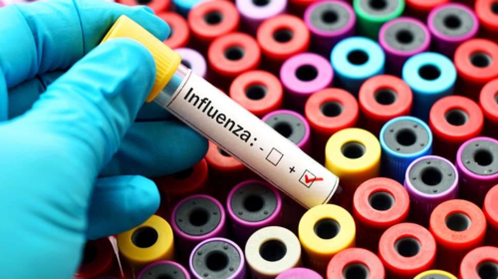 Flu Burung dari Dua Musim Gugur-Semi Terakhir Kembali Melanda Jepang